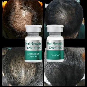 Exos GHK-Cu Hair Growth Lyophilized Powder Professional Anti Hair Loss Follicle Stimulation Regrowth Treatment Solution