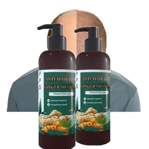 Factory Price Treatment Hair Regrowth Shampoo Conditioner Ginger Shampoo