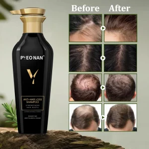 Factory Private Label Anti Hair Loss and Hair Growth Shampoo Antibacterial Shampoo for Anti Dandruff and Anti Hair Loss Control
