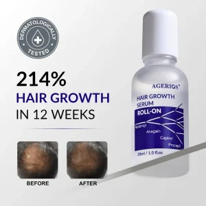 Fast Acting Redensyl Caffeine Hair Regrowth Serum Rapid Hair Thickening with 8 Weeks Visible Results Thinning Hair Treatment