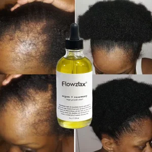 Fast Hair Growth Oil Natural Vegan Treatment for Anti Hair Loss Argan+Rosemary Hair Growth Oil