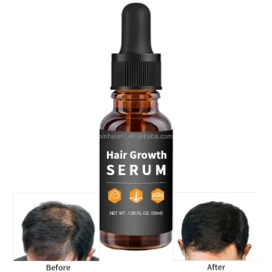 Fast Hair Growth Oil for Black Women Hair Regrowth Treatment Serum