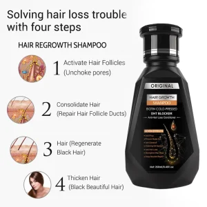 Ginger Biotin Anti Hair Loss Shampoo for Men Women Dandruff Control and Oily Scalp Care with Keratin Hair Growth Treatment 250ml