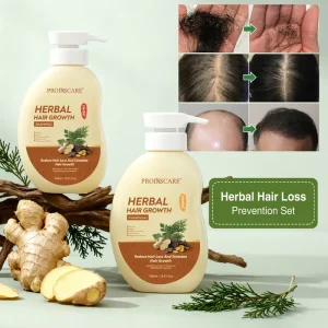 Grow Hair Shampoo Natural Plant Extract Reduce Hair Loss Herbal Hair Growth Shampoo