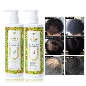 Hair Care Set Natural Biotin Tea Tree Oil Rosemary Mint Hair Growth Conditioner for Treatment Hair Loss
