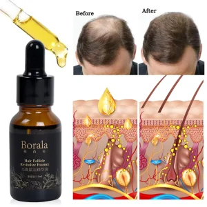Hair Follicle Activation Essence Hair Regrowth Oil