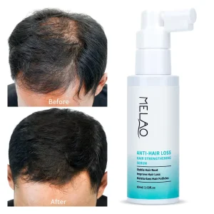 Hair Growth Products Men Women Scalp Serum Hair Loss Dry Damaged Repair Natural Hair Growth Serum