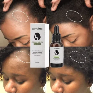 Hair Growth Serum Care Anti Hair Loss with Private Label