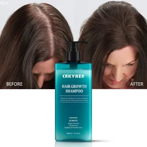 Hair Growth Shampoo With Biotin and Caffeine for Hair Loss Organic Damaged Hair Care Natural Nourishing Anti Dandruff Treatment