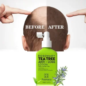 Hair Growth Spray Anti Hair Loss Lotion Treatment for Men Natural with Regrowth Hair Care Tonic Serum