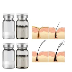 Hair Loss Treatment Hair Regrowth Treatment Private Label Ingrown Hair Treatment Products