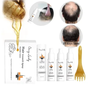 Hair Regrowing Anti Falling Anti Baldness Ginger Alopecia Treatment Serum Men Hair Growth
