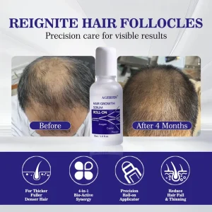 Hair Regrowth Serum with Redensyl, Capixyl, Procapil & Anagain for Non Hormonal Hair Loss