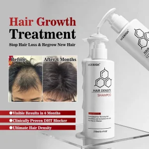 Hair Regrowth Shampoo Conditioner Serum with 5% Actives & Natural DHT Blockers Complete Treatment for Thinning Hair & Hair Loss