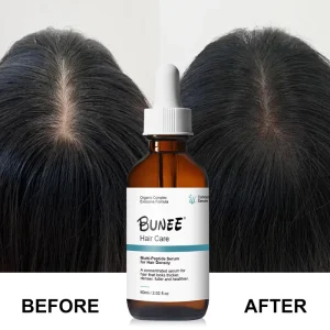 Hair Tonic Growth Oil Multi Peptide Polygonum Multiflorum Hair Growth Hair Regrowth Serum