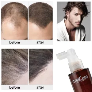 Hair Tonic Hair Growth Treatment for Women Men With Thinning Hair Loss