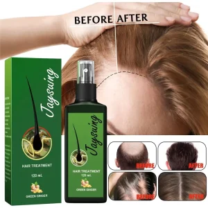 Hair growth spray nourishing root hair thick growth liquid anti-fall hair-fixing spray