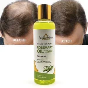 Handmade Rosemary Hair Growth Oil 100% Naturally Nourishes Hair