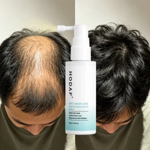Herbal Anti Hair Loss Hair Strengthen Serum Spray Nourish Repair Damaged Hair Boost Hair Regrowth Promote Healthy Scalp Care