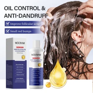 Herbal Anti Itch Anti Acne Shampoo 250ml Natural Plant Extract for Scalp Psoriasis Dandruff and Oil Control