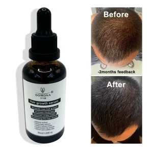 Herbal Organic Hair Growth Serum and Oil with Tea Tree Oil Repair Damaged Hair Fall Treatment Shampoo and Conditioner Set