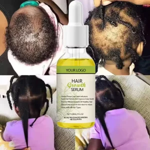Herbal Repair Scalp Serum Hair Growth Oil with Keratin Rosemary Anti Hair Loss Treatment