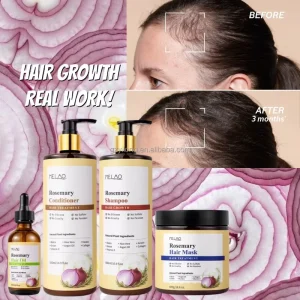 Herbal Rosemary & Onion Infused Biotin Hair Growth Shampoo Set Natural Ingredients for Effective Hair Regrowth