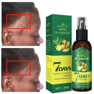 Herbicos Green Ginger Anti Hair Prevent Loss Oil Ginger 7 Days Hair Growth Nourishing Regrowth Spray King of Ginger Spraying