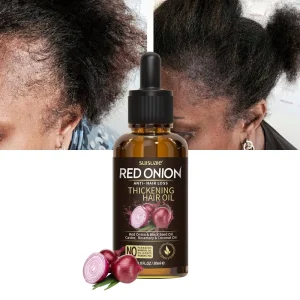 Home Use Pure Moisturizing Nourishing Repairing Argan Castor Red Onion Hair Growth Oil Serum