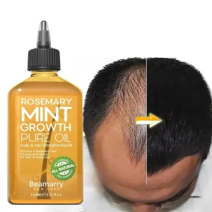 In Stock Natural Pure Hair Growth Essential Oil Anti Loss Regrowth for Hair Loss Treatment Regrowth Serum