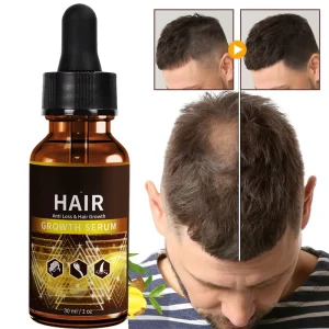 Indian Wild Organic Treatment Rosemary Castor Black Seed Baby Fast Hair Growth Oil for Black Women Men Private Label
