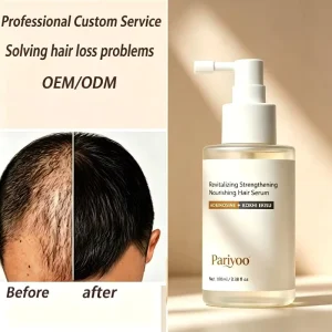 Intensive Alopecia Hair Loss Treatment Baldness Treatment Hair Regrowth Tonics Liquid