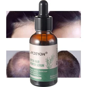 JADEYON Natural Hair Serum Private Unisex Castor Oil Rosemary Mint Scalp Hair Treatment Products Hair Growth Serum