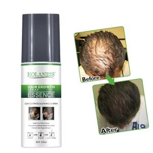 KOLANBIS Organic 100% Natural Herbal Hair Growth Product Set Shampoo and Serum for Men and Woman 100ml