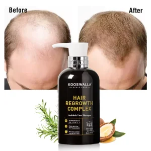 Kooswalla High Quality 100% Natural Anti Hair Loss Hair Regrowth Essence Biotin Shampoo OEM Formula Cream