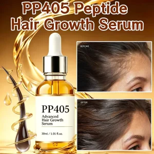 M PP405 Peptide Advanced Hair Growth Serum Stimulates Growth Scalp Hair Regrowth Strengthening Hair Scalp for Women Men OEM ODM