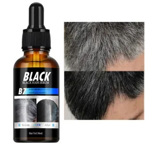 MOIKA High Quality 30ml Effective Gray White to Black Hair Treatment Hair Essence Oil Organic Hair Repairing Serum