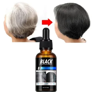 MOIKA Hot Selling Natural Herbal Darkening Hair Serum Activate Follicle Anti White Gray Hair Recolor Serum Hair Repair Care