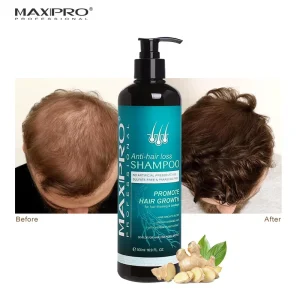 Maxipro Anti Hair Loss Shampoo and Conditioner Growth Shampoo for Thinning Hair Nourishing Anti Dandruff Hair Care Products