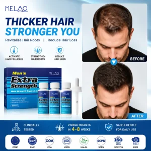Men’s Extra Strength Hair Regrowth Treatment Serum for Thinning Hair & Receding Hairline