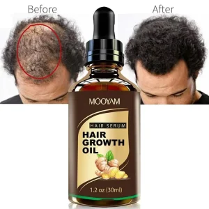 Most Sold Scalp Hair Growth Products Repair Anti Hair Falling Men Organic Hair Growth Oil for Baldness