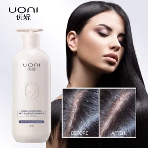 Natural Anti Dandruff Removing Shampoo Refreshing Moisturizing Oil Control Deep Cleansing Ginger Dandruff Shampoo