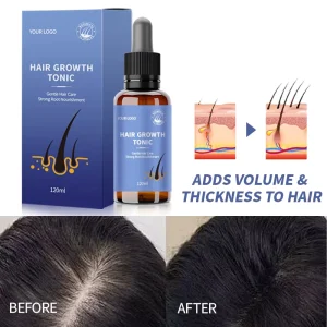 Natural Extract 100ml Hair Regrowth Anti Loss Gingseng Herbal Biotin Hair Growth Serum Private Label
