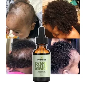 Natural Hair Care Products Rosemary Mint Essential Oil Nourish Anti Dandruff for Anti Loss Hair Treatment