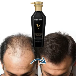 Natural Herbal Anti Hair Loss Shampoo and Conditioner Set Healthy Scalp for Hair Fall Anti Loss Hair Regrowth Thickness Shampoo