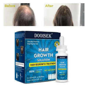 Natural Organic Anti Loss Regrowth Fast Hair Growth Oil Serum for Men Hair Grow Produits De Pousse Des Cheveux