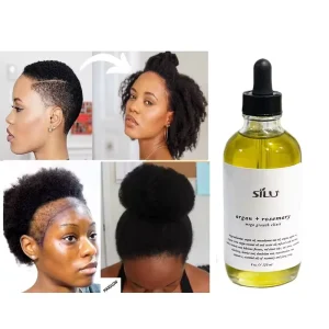 Natural Organic Anti Loss Regrowth Treatment Scalp Elixirs Ginger Hair Growth Oil Serum