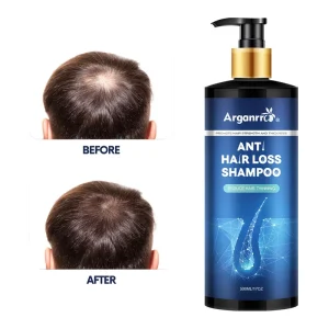 Natural Organic Hair Growth Shampoo for Men Nourishes the Scalp Strengthens
