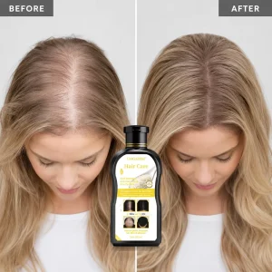Natural Organic Hair Men Women Growth Shampoo Hair Regrowth Anti Hair Loss Shampoo