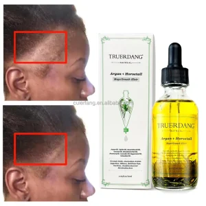 Natural Organic Horsetail Regrowth Anti Loss Rosemary Hair Growth Oil Hair Care Essential Oil for Black Women
